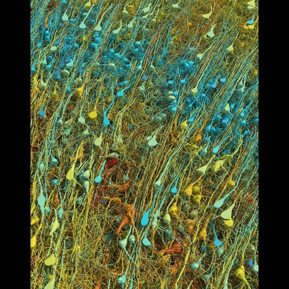 Close-up-view-of-excitatory-neuron
